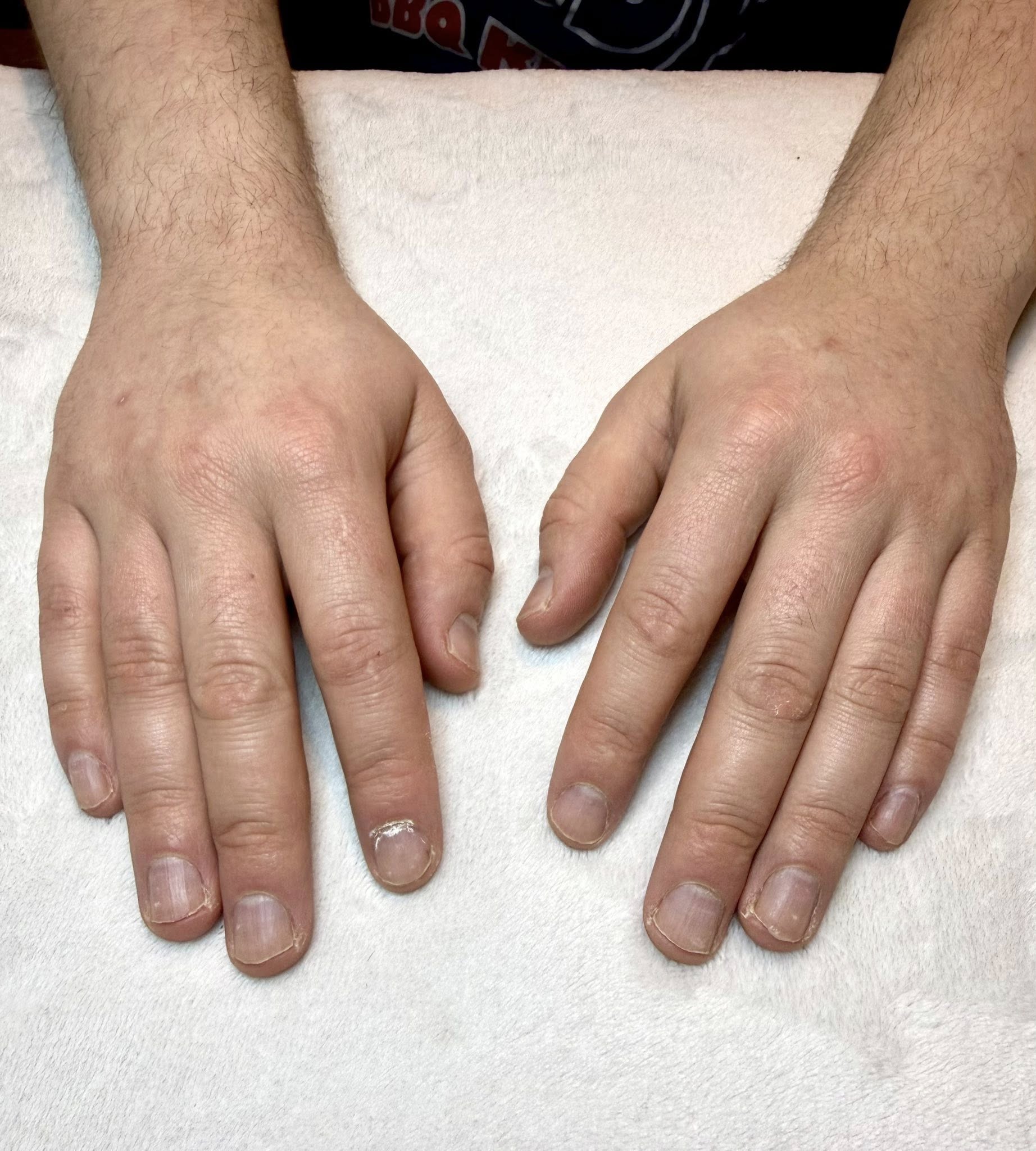 The Truth About "Weak Nails": What's Normal, What's Not, and How to Support Them